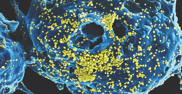 Scanning electron microscope image of MERS