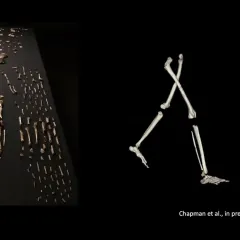 A skeleton laid out on a table and an illustration of skeletal legs walking.