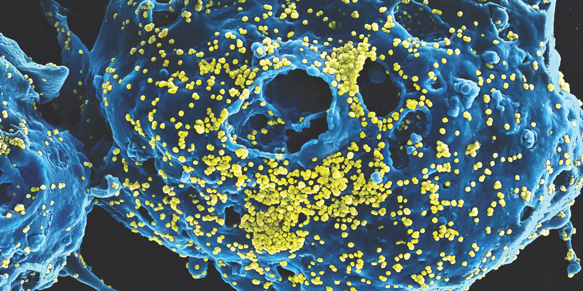 Scanning electron microscope image of MERS