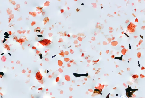 Dozens of grains of fossil pollen, of many different shapes, on a slide, magnified.