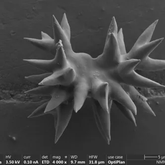 The image above shows a spicule from a new discovered sponge species in the Gulf of Mexico. The spicule has a dumbbell shape with spikes processes coming from all sides.