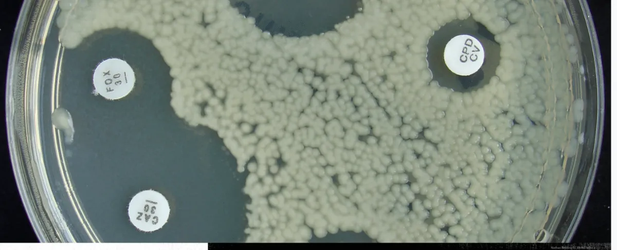 a white and clear petri dish